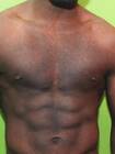 Blackson