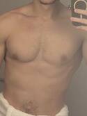 Anthony