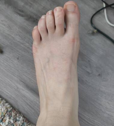 Sweatyfeet