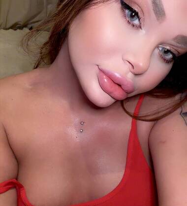 Alla