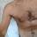 Thomaz