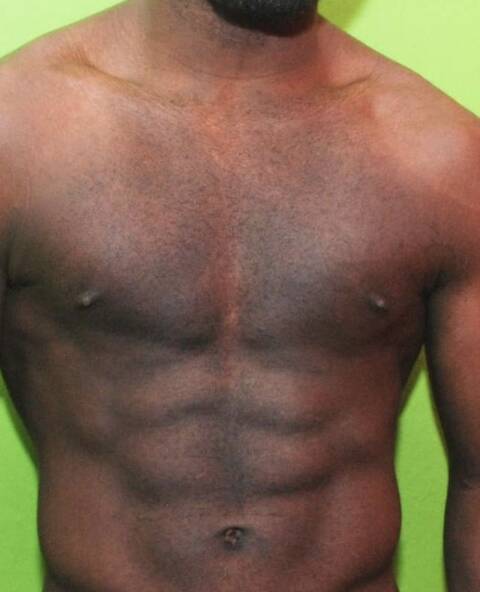 Blackson