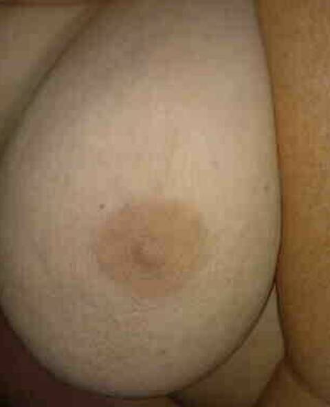 Vollere damexx