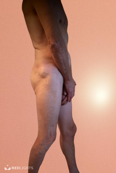 Man2Man