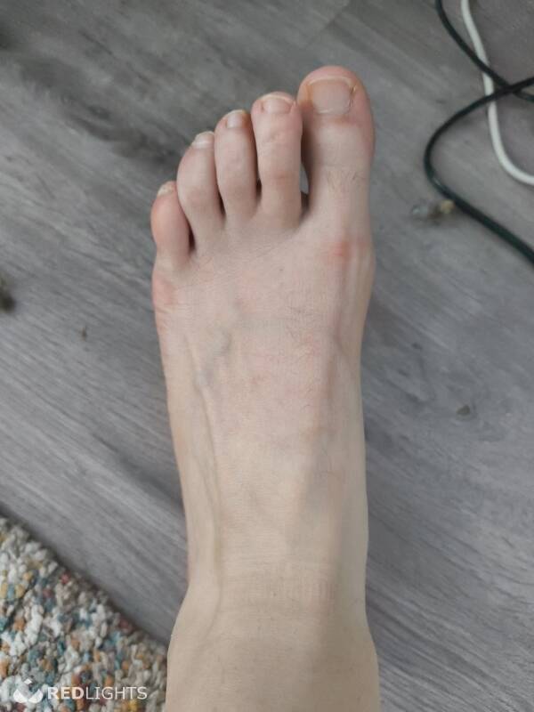 Sweatyfeet (Foto)