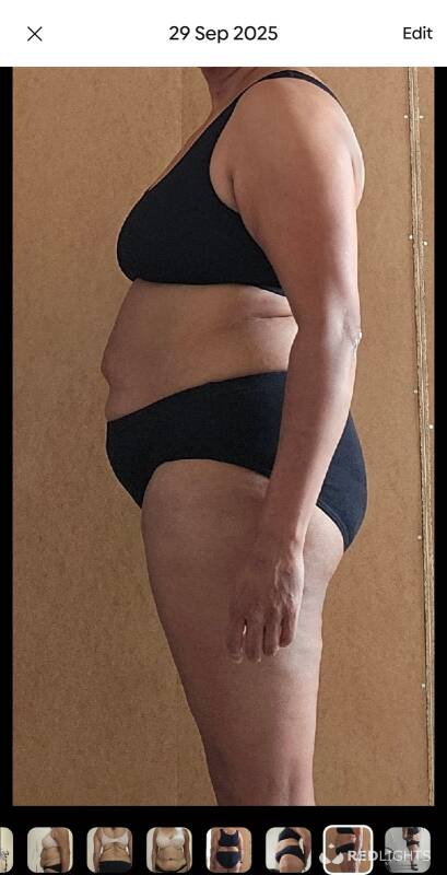 Cara (Foto)