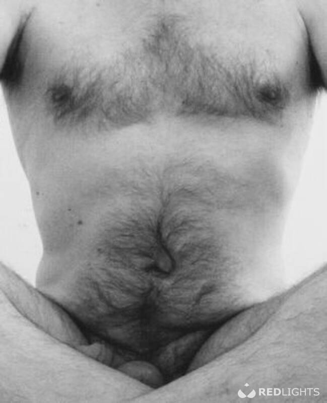 Tantra (Foto)