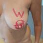 VAGINELLA (Foto #151)